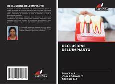 Buchcover von OCCLUSIONE DELL'IMPIANTO