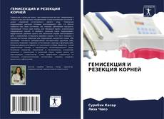 Portada del libro de ГЕМИСЕКЦИЯ И РЕЗЕКЦИЯ КОРНЕЙ