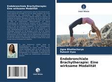 Capa do livro de Endobronchiale Brachytherapie: Eine wirksame Modalität 