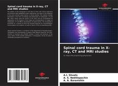 Borítókép a  Spinal cord trauma in X-ray, CT and MRI studies - hoz