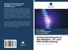 Buchcover von Rückenmarkstrauma in der Röntgen-, CT- und MRT-Untersuchung