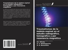 Couverture de Traumatismos de la médula espinal en el estudio radiográfico, tomográfico y por resonancia magnética