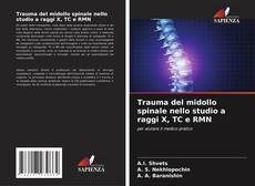 Обложка Trauma del midollo spinale nello studio a raggi X, TC e RMN