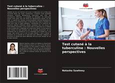 Couverture de Test cutané à la tuberculine : Nouvelles perspectives