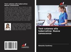 Test cutaneo alla tubercolina: Nuove conoscenze kitap kapağı