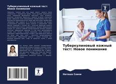 Portada del libro de Туберкулиновый кожный тест: Новое понимание