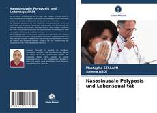 Buchcover von Nasosinusale Polyposis und Lebensqualität