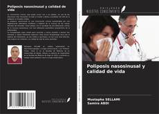 Couverture de Poliposis nasosinusal y calidad de vida