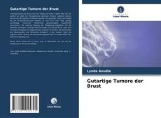 Buchcover von Gutartige Tumore der Brust