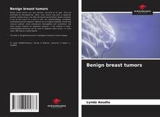 Couverture de Benign breast tumors