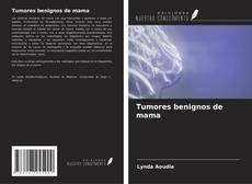 Couverture de Tumores benignos de mama