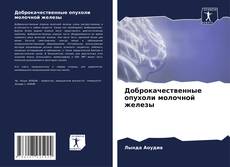 Capa do livro de Доброкачественные опухоли молочной железы 