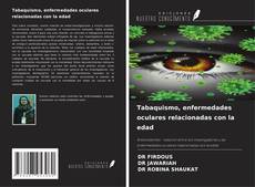 Buchcover von Tabaquismo, enfermedades oculares relacionadas con la edad