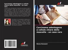 Buchcover von Carcinoma odontogeno a cellule chiare della mascella - un caso raro