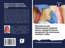 Минимальное образование рубцов после хирургических разрезов по основным линиям сгиба的封面