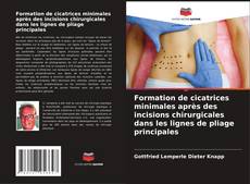 Capa do livro de Formation de cicatrices minimales après des incisions chirurgicales dans les lignes de pliage principales 