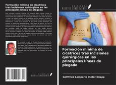 Couverture de Formación mínima de cicatrices tras incisiones quirúrgicas en las principales líneas de plegado