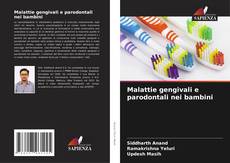 Buchcover von Malattie gengivali e parodontali nei bambini