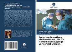 Buchcover von Apoptose in nativen Venenwänden, die für Hämodialysezugänge verwendet werden