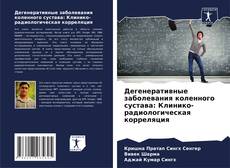 Buchcover von Дегенеративные заболевания коленного сустава: Клинико-радиологическая корреляция
