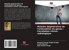 Buchcover von Maladie dégénérative de l'articulation du genou : Corrélation clinico-radiologique