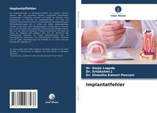 Buchcover von Implantatfehler