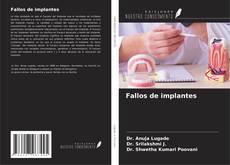 Couverture de Fallos de implantes