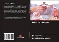 Échecs d’implants kitap kapağı