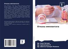 Capa do livro de Отказы имплантата 