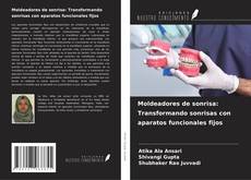 Couverture de Moldeadores de sonrisa: Transformando sonrisas con aparatos funcionales fijos