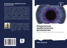 Buchcover von Клиническая диабетическая ретинопатия