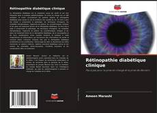 Buchcover von Rétinopathie diabétique clinique