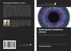 Couverture de Retinopatía diabética clínica