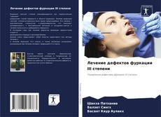 Лечение дефектов фуркации III степени kitap kapağı