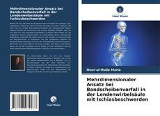 Buchcover von Mehrdimensionaler Ansatz bei Bandscheibenvorfall in der Lendenwirbelsäule mit Ischiasbeschwerden