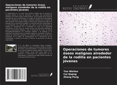 Portada del libro de Operaciones de tumores óseos malignos alrededor de la rodilla en pacientes jóvenes