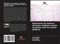 Buchcover von Opérations de tumeurs osseuses malignes autour du genou chez les jeunes patients