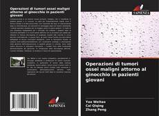 Couverture de Operazioni di tumori ossei maligni attorno al ginocchio in pazienti giovani