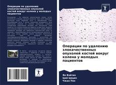 Capa do livro de Операции по удалению злокачественных опухолей костей вокруг колена у молодых пациентов 