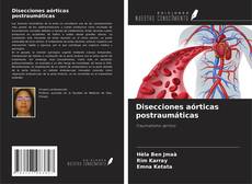 Couverture de Disecciones aórticas postraumáticas