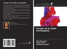 Portada del libro de Cirugía de la triple valvulopatía