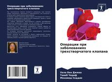 Capa do livro de Операции при заболеваниях трехстворчатого клапана 