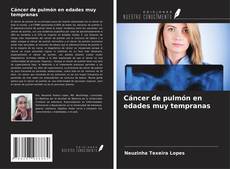 Portada del libro de Cáncer de pulmón en edades muy tempranas