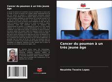 Capa do livro de Cancer du poumon à un très jeune âge 