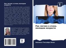 Bookcover of Рак легких в очень молодом возрасте