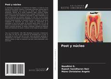 Portada del libro de Post y núcleo