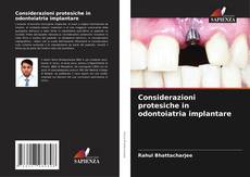 Обложка Considerazioni protesiche in odontoiatria implantare