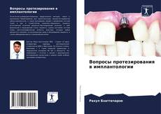 Portada del libro de Вопросы протезирования в имплантологии