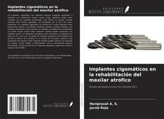 Couverture de Implantes cigomáticos en la rehabilitación del maxilar atrófico