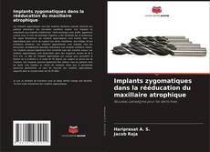 Buchcover von Implants zygomatiques dans la rééducation du maxillaire atrophique